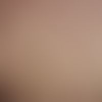 Malasseziafolliculitis:disseminated, follicle-bound, itchy, inflammatory papules and papulopustul...