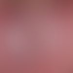 Lichen planus mucosae: flat, verrucous lichen planus of the oralmucosa; considerable burning disc...