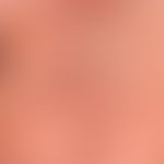 Varizellen:&nbsp;generalisiertes Exanthem mit Nebeneinander von Vesikeln, Papeln, Papulopusteln. ...