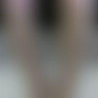 flat knitted compression garments usually have a visible seam where the flat finished products ar...