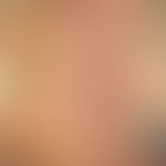 Vulva/Talgdrüsen. Innenseite&nbsp;der kleinen Labie&nbsp;in starker Vergrößerung. Abb. aus&nbsp;E...