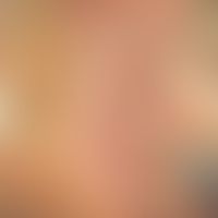 Vulva/Talgdrüsen. Innenseite&nbsp;der kleinen Labie&nbsp;in starker Vergrößerung. Abb. aus&nbsp;E...