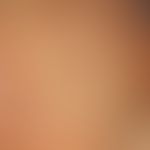 Vuvla: Talgdrüsen. Innenseiten der kleinen Labien in starker Vergrößerung (Detailaufnahme).&nbsp;...
