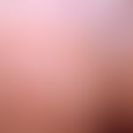 Herpes simplex recidivans: in loco rezidivender Herpes simplex. &nbsp;Abb. aus&nbsp;Eiko E. Peter...