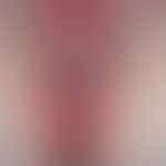 Rezidivierende, perianale Dermatitis und Vulvitis durch A-Streptokokken. 36-Jahre alte Patientin....