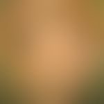 Lentiginosis of the mucosa. since persistent, multiple melanotic flecks of the vulva. 34-year-old...