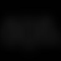 Structural formula of the anthraquinone derivative Rhine.
