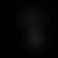 Structural formula of D-ephedrine.

