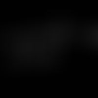 Structural formula of the sympathomimetic drug salbutamol.
