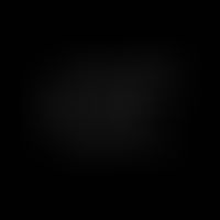 Strukturformel des Saligenins (= Salicylalkohol)
