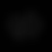 Sturkturformel des 1,4-Naphthochinonderivates Juglon
