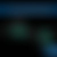 G-Proteine 3-gekoppelter transmembraner Rezeptor
