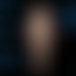 Melanom malignes: die&nbsp;5 häufigsten Lokalisationen des malignen Melanoms. Daten des Hauttumor...