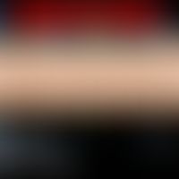 Epidermis - Umwelt und Reaktivität
