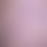 Anaesthesia: Pronounced reticular varices (spider veins), which start from a sack-shaped dilated ...