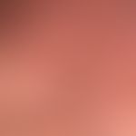 Syringome disseminierte: (Detailaufnahme des Skrotums); seit etwa 2 Jahren, unmerklich sich verme...