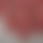 Systemic lupus erythematosus (late onset): chronic, sharply and bizarrely defined livid-red plaqu...