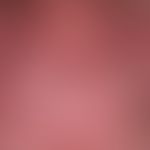 Systemic lupus erythematosus (late onset): chronic, sharply and bizarrely limited erythematous pl...