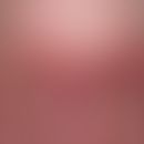 Lupus erythematodes systemischer (late onset):&nbsp;chronische, scharf und bizarr begrenzte eryth...