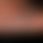Myzetome: Indolent, chronic granulomatous infection of the skin and subcutis with circumscribed, ...