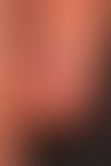 Normaler Nagel mit Bezeichnung der einzelnen Strukturen des Nagelorgans.&nbsp;
