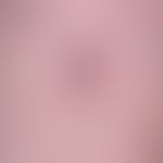 Nodules, flat raised, firm consistency: Dermatofibroma: long-standing, no longer growing, occasio...