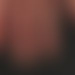 Pincer-nails: chronische kontaktallergische Dermatitis mit kontinuierlicher Ausbildung von Zangen...