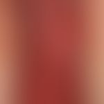 Drug reaction, fixed: acute, solitary, initially deep red painful erythema; after a few days exte...