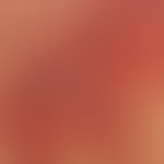 Basal cell carcinoma superficial: for several years existing, slow-growing, symptomless red plaqu...