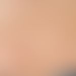 Erythema anulare centrifugum: offenabr im Abklingen begriffene, chronisch aktive, zentrifugal wac...
