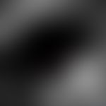 Comedo: Identical hair follicle in the corium, perforating there, laser scanning microscopy, - se...