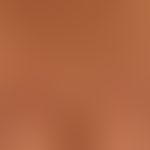 Lichen planus exanthematicus: small papular lichen planus with aggregation of the efflorescences ...
