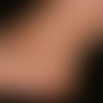 Pronounced livedo racemosa: Intermediate findings after 2 more years (period of clinical follow-u...