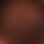 psoriasis capitis: chronically inpatient red plaques extending over the entire hairy scalp. no si...