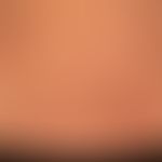 Dermatitis herpetiformis: Intensely itchy to painfully stinging urticarial plaques with tiny blis...