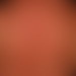 Systemic lupus erythematosus: acute maculopapular exanthema, accompanied by recurrent fever attac...