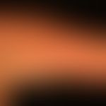 Systemic lupus erythematosus: acute maculopapular exanthema, accompanied by recurrent fever attac...