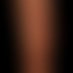 Lichen planus verrucosus: a hypertrophic lichen planus with pseudoepitheliomatous epithelial hype...
