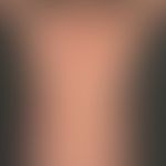 Kutanes T-Zell-Lymphom vom Typ der Mycosis fungoides: seit Jahren bestehendes, initial als "Parap...