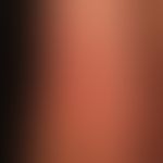 Anular erythema: Erythema infectiosum, butterfly-shaped redness and swelling of the cheeks in pat...
