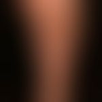 Pityriasis lichenoides et varioliformis acuta: acutely occurring "colorful" exanthema with differ...