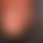 Melanonychia striata longitudinalis (2): control finding in 2016. widening of the longitudinal pi...