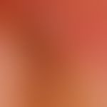 Melanonychia striata longitudinalis (2a): Control finding in 2016. detailed picture of the nail f...