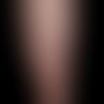 Necrobiosis lipoidica: bilateral, gradually increasing, moderately sharply defined, confluent, re...