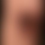 Pemphigus vulgaris:&nbsp;multiple, chronische, seit 3 Jahren schubweise verlaufende, symmetrische...