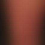 Urticaria pigmentosa (systemic mastocytosis): spots of varying size, disseminated, flat, oval or ...
