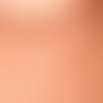 urticaria chronic spontaneous: multiple, chronically recurrent, reddish, partly confluent wheals,...