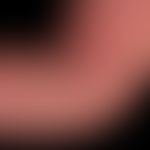 Pustulose, akute generalisierte exanthematische: akut aufgetretenes erythrodermisches Exanthem mi...
