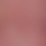 Urticaria chronic spontaneous: multiple, chronically recurrent, red, partly confluent wheals, wit...