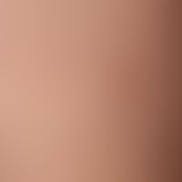 Xanthogranuloma juveniles (sensu strictu). soft elastic, yellowish, completely asymptomatic, hard...